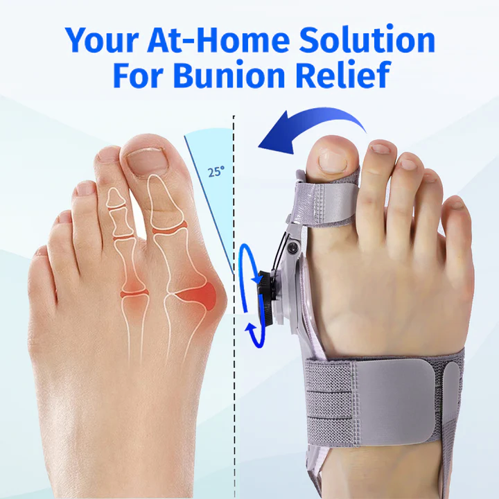 NordicMedix Bunion Fix