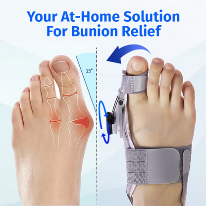 NordicMedix Bunion Fix
