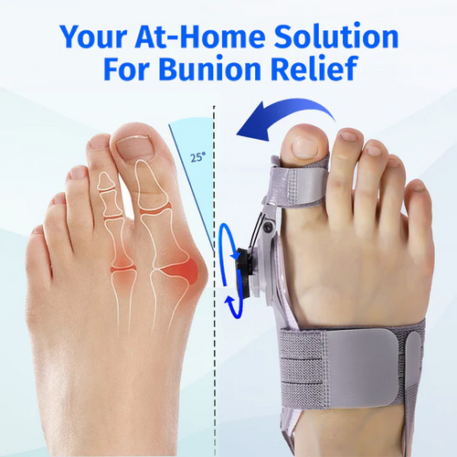 NordicMedix Bunion Fix