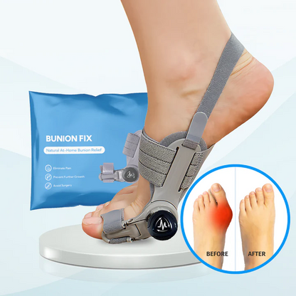 NordicMedix Bunion Fix